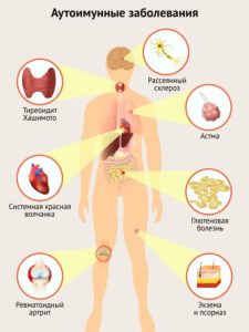 Аутоиммунные заболевания